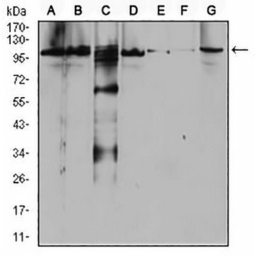 RAB11FIP1 Mouse Monoclonal Antibody(C2925)