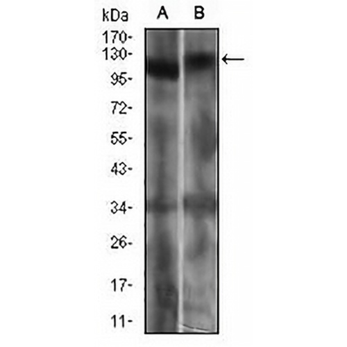 RB1 Mouse Monoclonal Antibody(C2938)