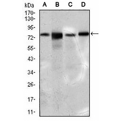 FATP5 Mouse Monoclonal Antibody(C2964)