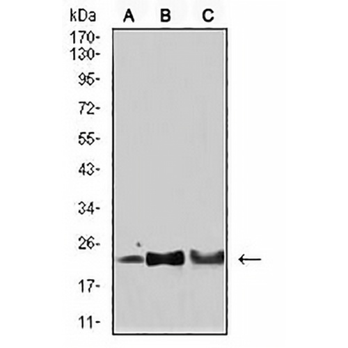 SOD2 Mouse Monoclonal Antibody(C2972)