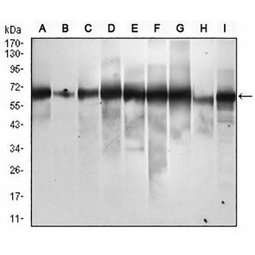 p62 Mouse Monoclonal Antibody(C2976)