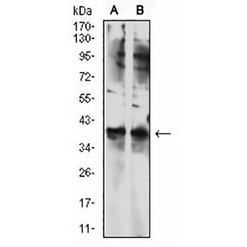 TBP Mouse Monoclonal Antibody(C2983)