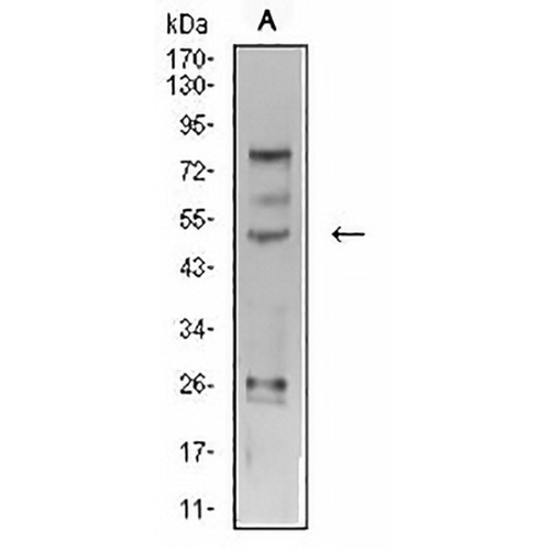 AP2 gamma Mouse Monoclonal Antibody(C2988)