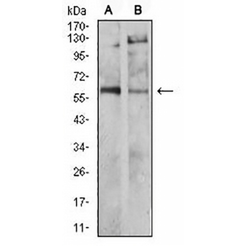 Tyrosine Hydroxylase Mouse Monoclonal Antibody(C2991)
