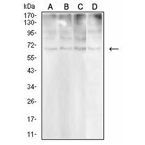 CD30 Mouse Monoclonal Antibody(C3000)