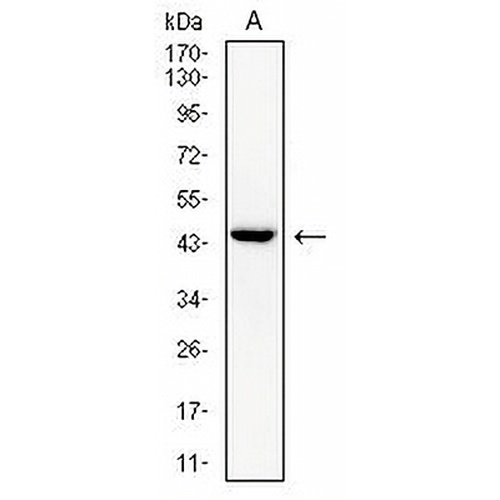 cTnT Mouse Monoclonal Antibody(C3005)