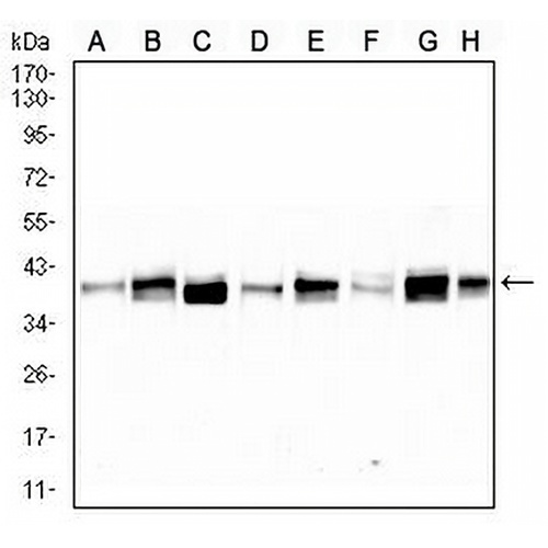 TRBC1 Mouse Monoclonal Antibody(C3009)