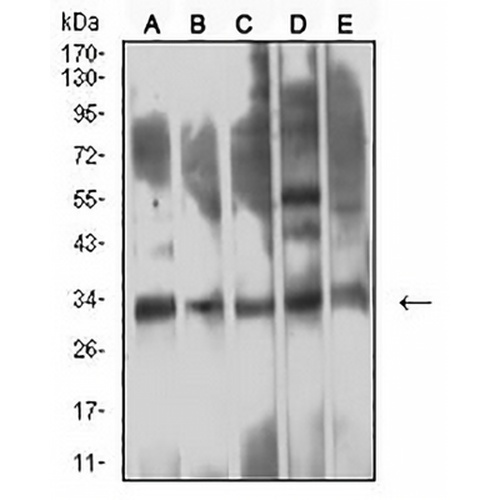CD354 Mouse Monoclonal Antibody(C3010)