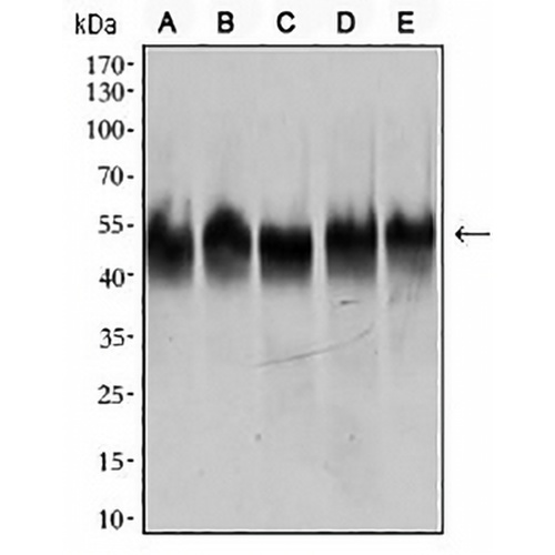 Beta2A-tubulin Mouse Monoclonal Antibody(C3019)