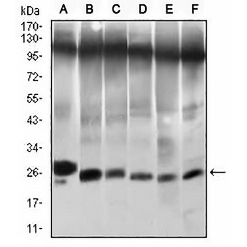 TWIST Mouse Monoclonal Antibody(C3020)