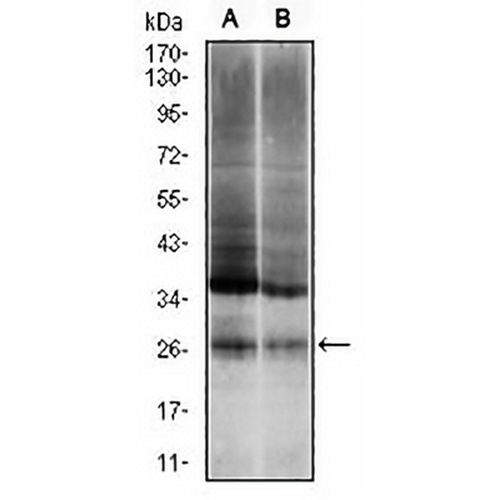 UBB Mouse Monoclonal Antibody(C3021)