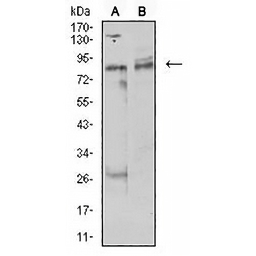 UHRF1 Mouse Monoclonal Antibody(C3024)