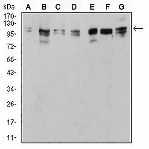 ULK2 Mouse Monoclonal Antibody(C3025)