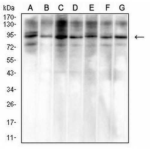 VCP Mouse Monoclonal Antibody(C3034)