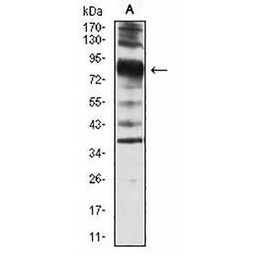 Villin Mouse Monoclonal Antibody(C3037)