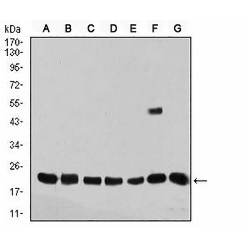 Selenoprotein S Mouse Monoclonal Antibody(C3039)