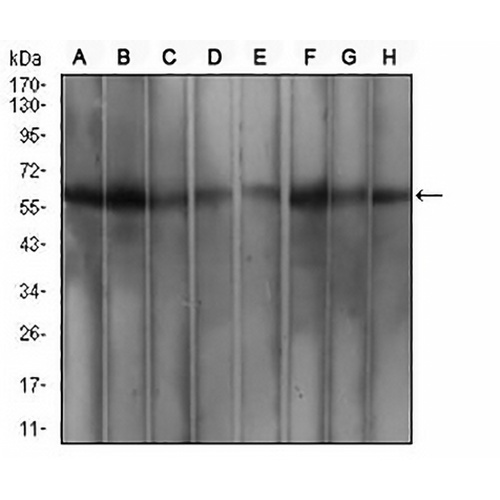 WTAP Mouse Monoclonal Antibody(C3041)