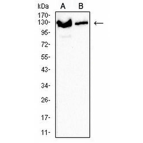 XPC Mouse Monoclonal Antibody(C3042)