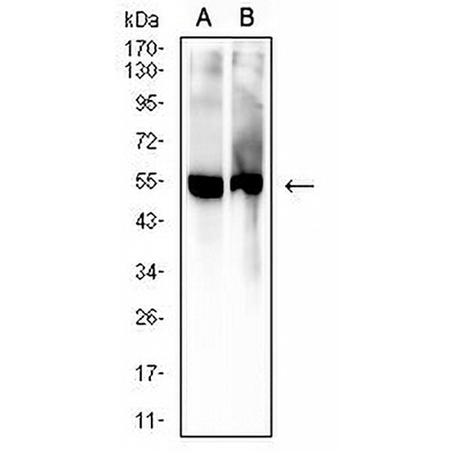 5-hydroxyuridine Mouse Monoclonal Antibody(C3053)