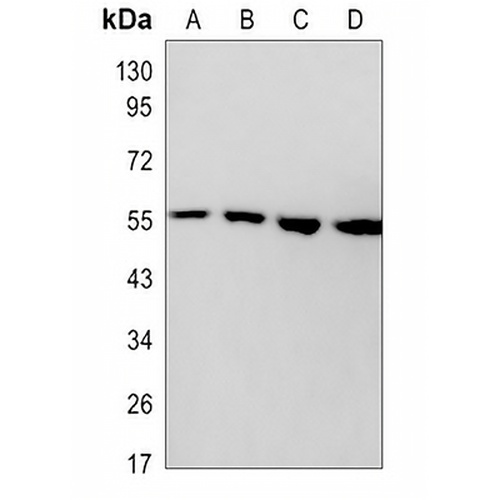 AKT Rabbit Monoclonal Antibody(C3054)