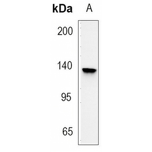 E Cadherin Rabbit Monoclonal Antibody(C3056)