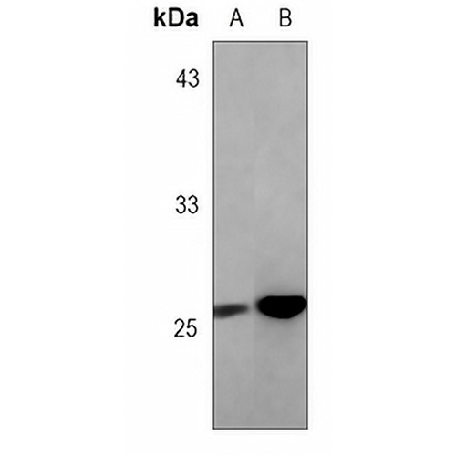 BCL2 Rabbit Monoclonal Antibody(C3057)