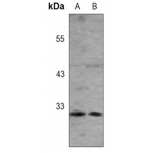 CD273 Rabbit Monoclonal Antibody(C3059)