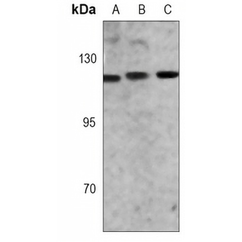 NAT10 Rabbit Monoclonal Antibody(C3061)