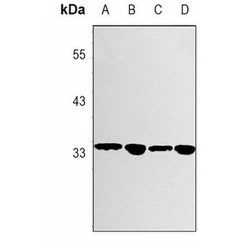 GNB2 Rabbit Monoclonal Antibody(C3062)