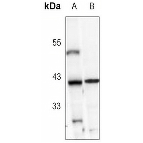 IKB alpha Rabbit Monoclonal Antibody(C3066)