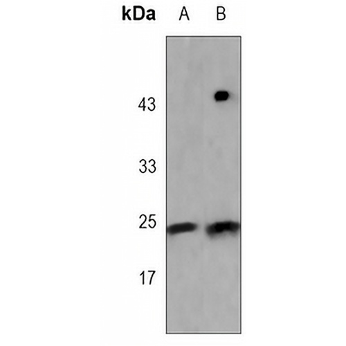 TCF6 Rabbit Monoclonal Antibody(C3067)