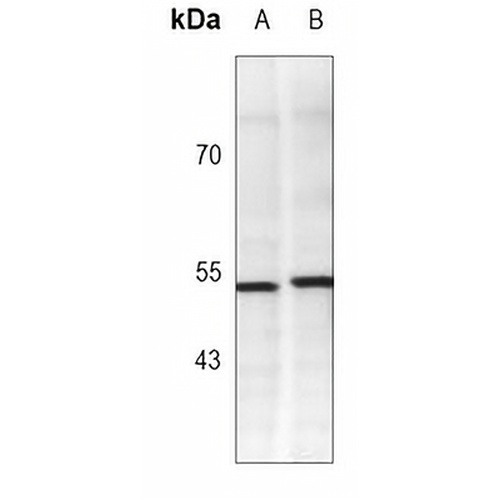WTAP Rabbit Monoclonal Antibody(C3068)