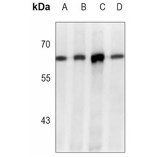 ABCE1 Rabbit Monoclonal Antibody(C3069)