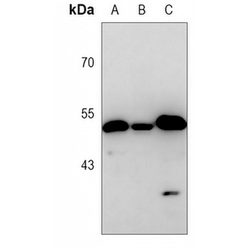 PGD Rabbit Monoclonal Antibody(C3070)