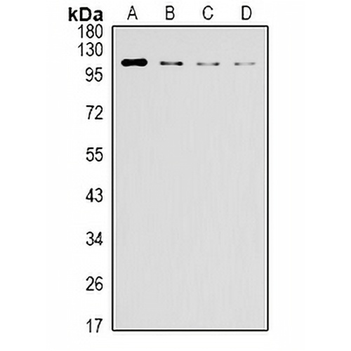IRE1 Mouse Monoclonal Antibody(C3073)