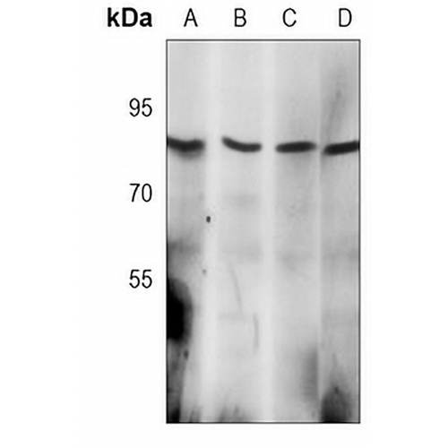 MLH1 Rabbit Monoclonal Antibody(C3074)