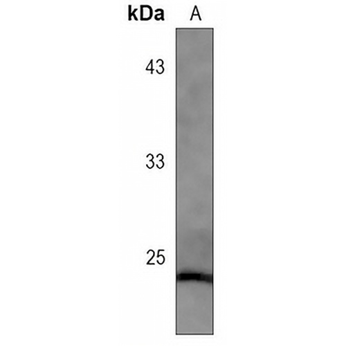 Caveolin 1 Rabbit Monoclonal Antibody(C3076)
