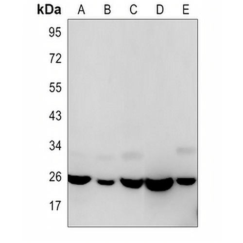 HMGB1 Rabbit Monoclonal Antibody(C3078)