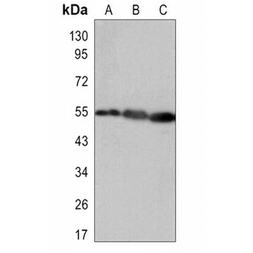 Vimentin Rabbit Monoclonal Antibody(C3080)