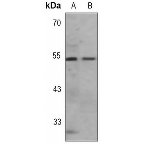 GFAP Rabbit Monoclonal Antibody(C3081)