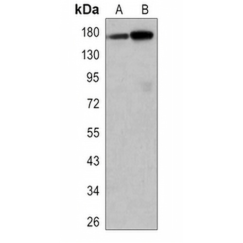 EGFR Rabbit Monoclonal Antibody(C3082)
