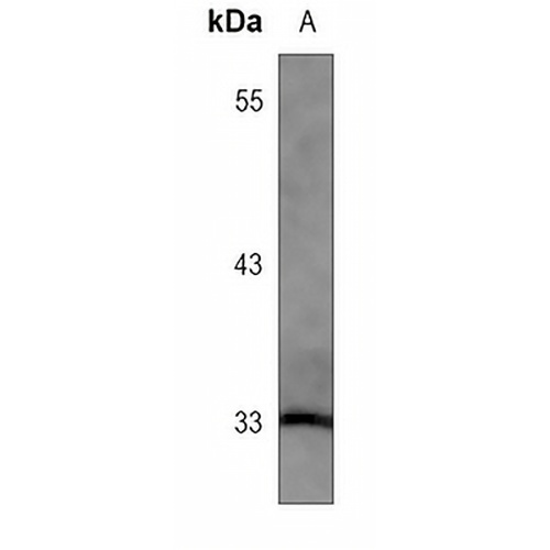 HO-1 Rabbit Monoclonal Antibody(C3087)