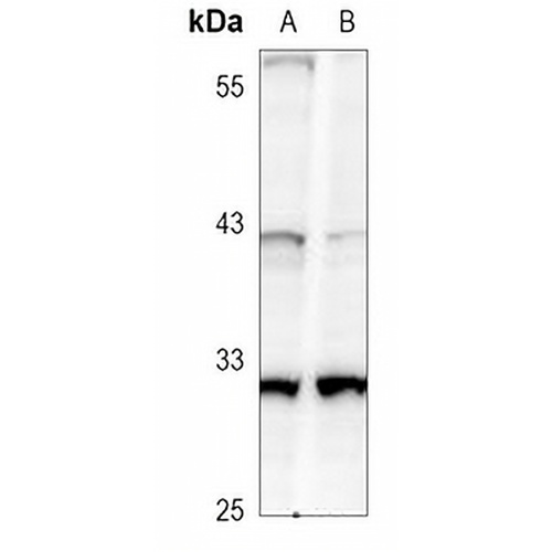 Caspase 3 Rabbit Monoclonal Antibody(C3089)