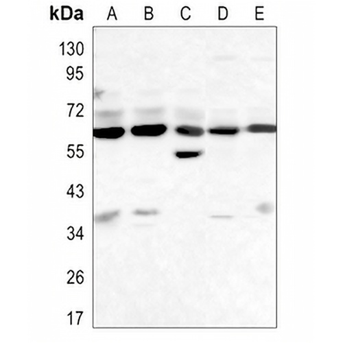 Beclin-1 Rabbit Monoclonal Antibody(C3094)