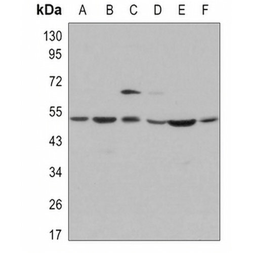 JNK1 Rabbit Monoclonal Antibody(C3095)
