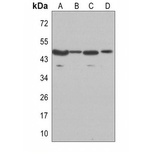 GSK3 beta Rabbit Monoclonal Antibody(C3097)