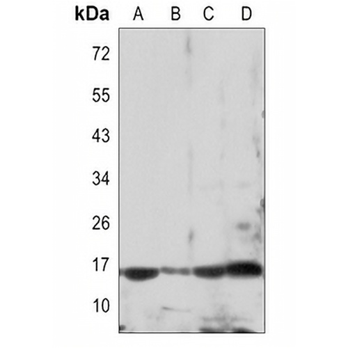 p16 ARC Rabbit Monoclonal Antibody(C3099)