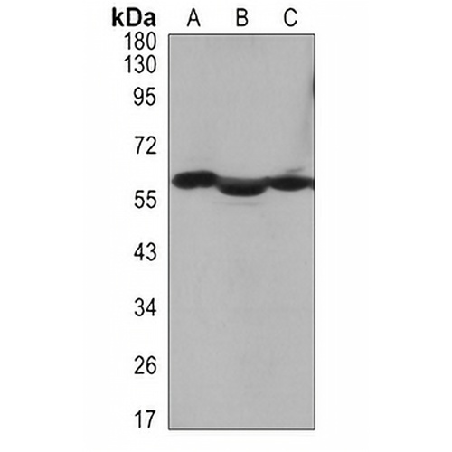 Cytokeratin 10 Rabbit Monoclonal Antibody(C3100)