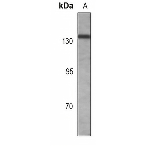 RB2 (Phospho-T986) Rabbit Monoclonal Antibody(C3103)