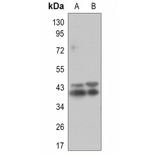 ERK1/2 (Phospho-T202/T185) Rabbit Monoclonal Antibody(C3104)